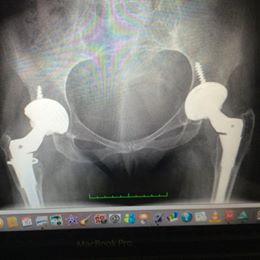 27496266_10213814870959631_1398618393_n