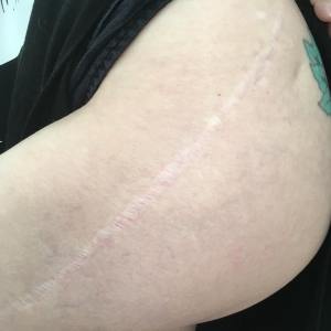 27536831_10213814870919630_1673017918_o